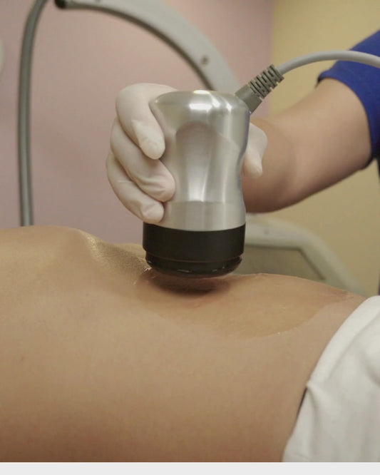 Cavitación (abdomen)