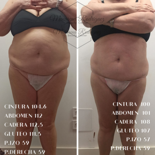 CINTURA 104,6 ABDOMEN 112 CADERA 112,5 GLUTEO 111,5 P.IZQ 59 P.DERECHA 59 (1)