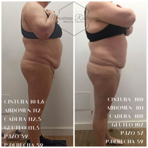 CINTURA 104,6 ABDOMEN 112 CADERA 112,5 GLUTEO 111,5 P.IZQ 59 P.DERECHA 59