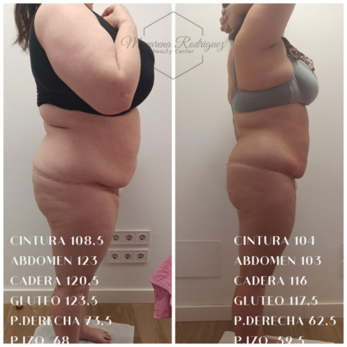 CINTURA 108,5 ABDOMEN 123 CADERA 120,5 GLUTEO 123,5 P.DERECHA 73,5 P.IZQ 68 (1)