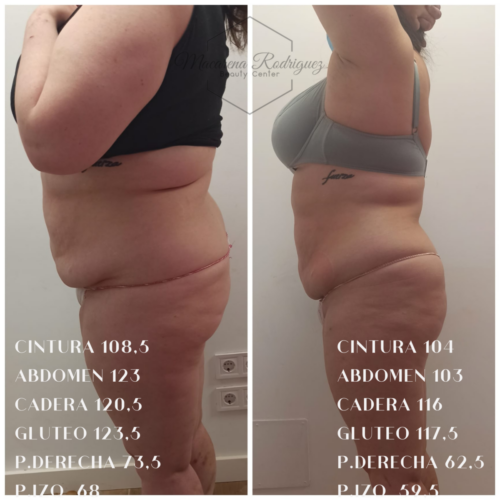 CINTURA 108,5 ABDOMEN 123 CADERA 120,5 GLUTEO 123,5 P.DERECHA 73,5 P.IZQ 68 (2)