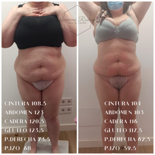 CINTURA 108,5 ABDOMEN 123 CADERA 120,5 GLUTEO 123,5 P.DERECHA 73,5 P.IZQ 68 (3)