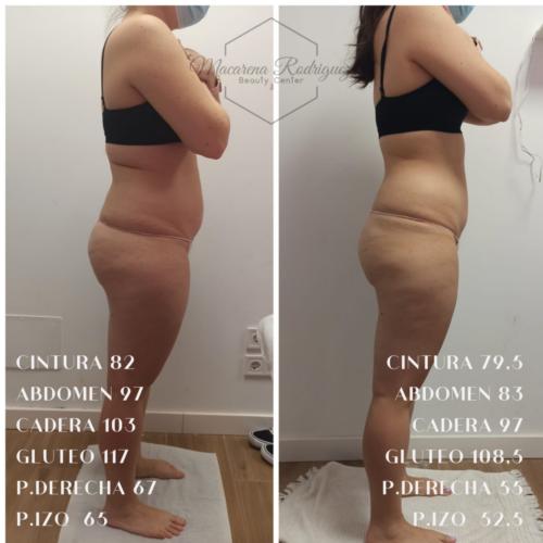 CINTURA 108,5 ABDOMEN 123 CADERA 120,5 GLUTEO 123,5 P.DERECHA 73,5 P.IZQ 68 (4)