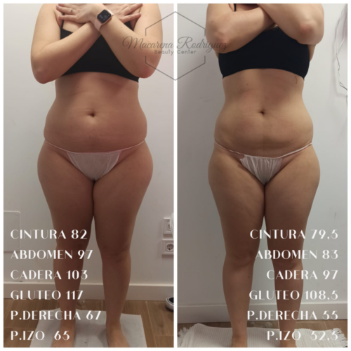 CINTURA 108,5 ABDOMEN 123 CADERA 120,5 GLUTEO 123,5 P.DERECHA 73,5 P.IZQ 68 (5)