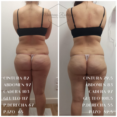 CINTURA 108,5 ABDOMEN 123 CADERA 120,5 GLUTEO 123,5 P.DERECHA 73,5 P.IZQ 68 (6)