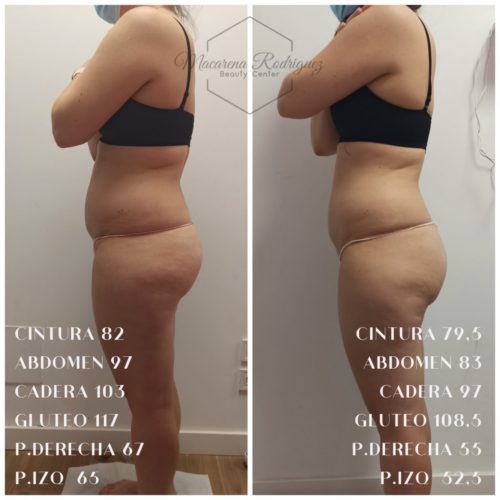 CINTURA 108,5 ABDOMEN 123 CADERA 120,5 GLUTEO 123,5 P.DERECHA 73,5 P.IZQ 68 (7)
