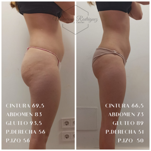 CINTURA 108,5 ABDOMEN 123 CADERA 120,5 GLUTEO 123,5 P.DERECHA 73,5 P.IZQ 68 (8)