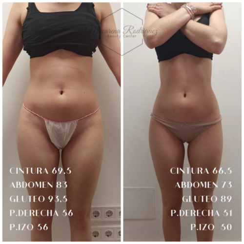 CINTURA 108,5 ABDOMEN 123 CADERA 120,5 GLUTEO 123,5 P.DERECHA 73,5 P.IZQ 68 (9)