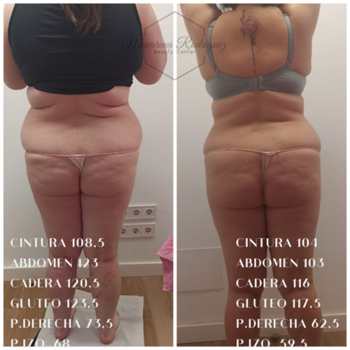 CINTURA 108,5 ABDOMEN 123 CADERA 120,5 GLUTEO 123,5 P.DERECHA 73,5 P.IZQ 68