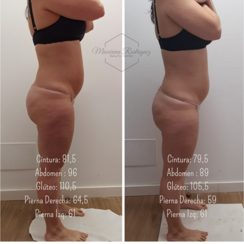 Cintura_ 81,5 Abdomen _ 96 Glúteo_ 110,5 Pierna Derecha_ 64,5 Pierna Izq_ 61 (2)