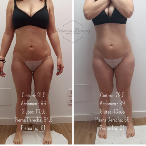 Cintura_ 81,5 Abdomen _ 96 Glúteo_ 110,5 Pierna Derecha_ 64,5 Pierna Izq_ 61 (3)