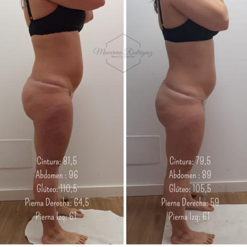 Cintura_ 81,5 Abdomen _ 96 Glúteo_ 110,5 Pierna Derecha_ 64,5 Pierna Izq_ 61 (4)