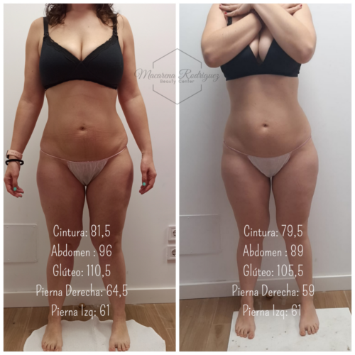 Cintura_ 81,5 Abdomen _ 96 Glúteo_ 110,5 Pierna Derecha_ 64,5 Pierna Izq_ 61