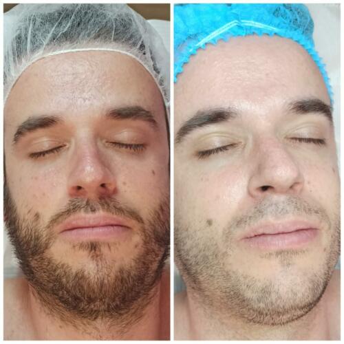 antes y después Mario