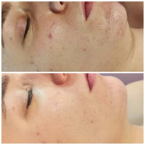 antes y después beatriz tamarit