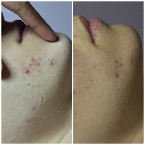 antes y después josune