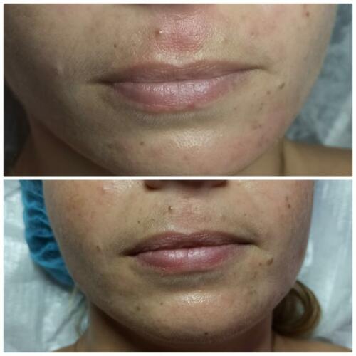 rehidratación marta 1 s